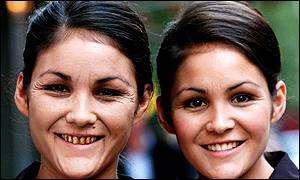 twins_b300.jpg